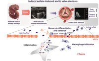 Graphical Abstract: The role of uremic toxin indoxyl sulfate in the pathophysiology of aortic valve stenosis