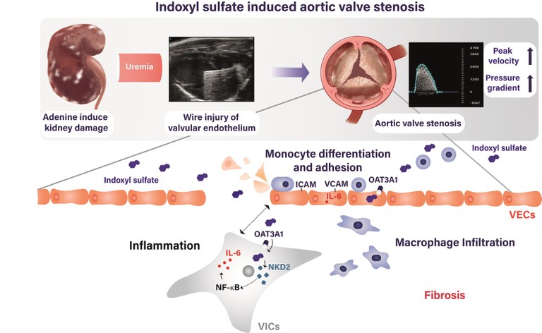 Graphical Abstract: The role of uremic toxin indoxyl sulfate in the pathophysiology of aortic valve stenosis